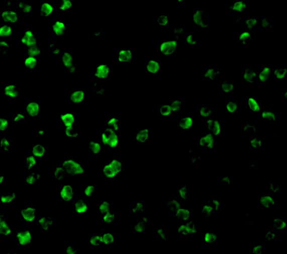 Immunocytochemistry/ Immunofluorescence: SARM1 Antibody - BSA Free [NBP1-77200] - Immunofluorescence of SARM1 in Daudi cells with SARM1 antibody at 2 ug/mL.