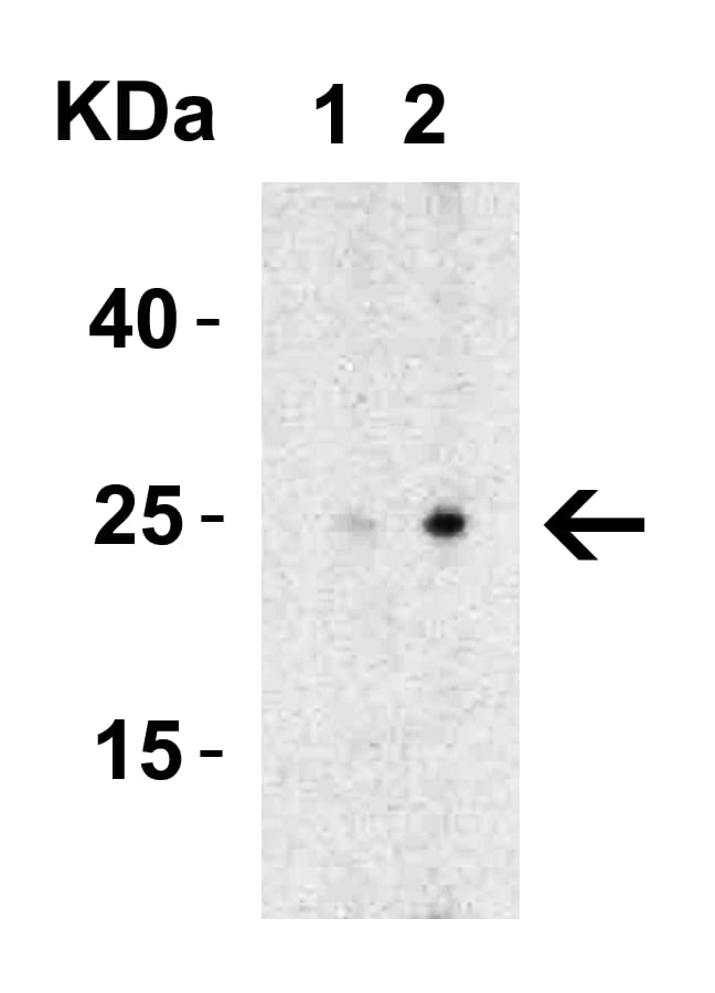 Western Blot: MD-2 Antibody - BSA Free [NBP1-77201] - Validation in Rat Spleen Tissue Lysate.Loading: 15 ug of lysates per lane.Antibodies: MD-2,  (Lane 1: 0.5 ug/mL and Lane 2: 1 ug/mL), 1h incubation at RT in 5% NFDM/TBST.Secondary: Goat anti-rabbit IgG HRP conjugate at 1:10000 dilution.