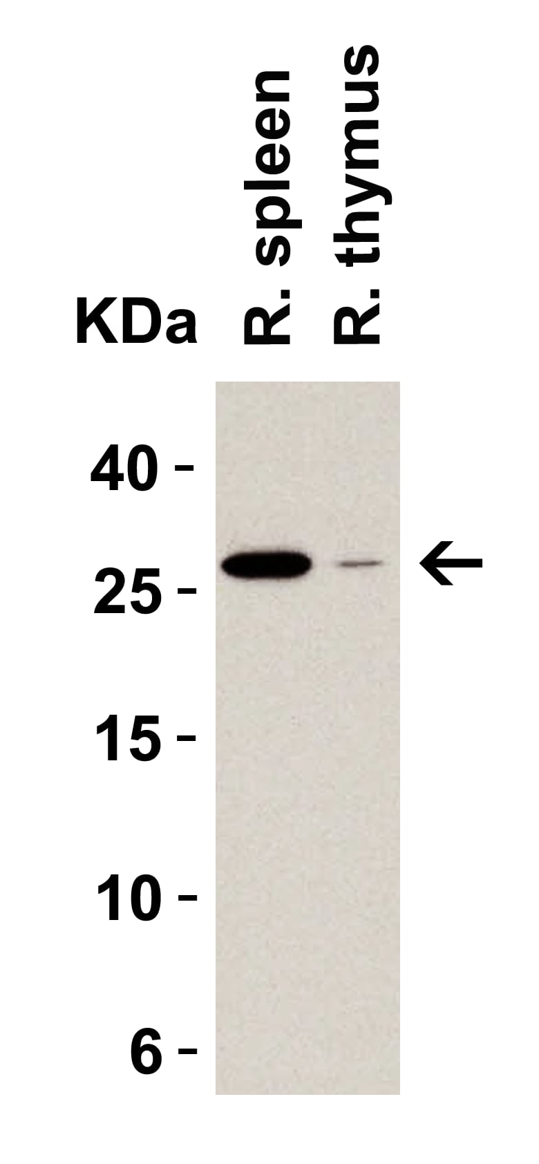 Western Blot: MD-2 Antibody - BSA Free [NBP1-77201] - Validation in Rat Tissue Lysates.Loading: 15 ug of lysates per lane.Antibodies: MD-2,  (1 ug/mL), 1h incubation at RT in 5% NFDM/TBST.Secondary: Goat anti-rabbit IgG HRP conjugate at 1:10000 dilution.