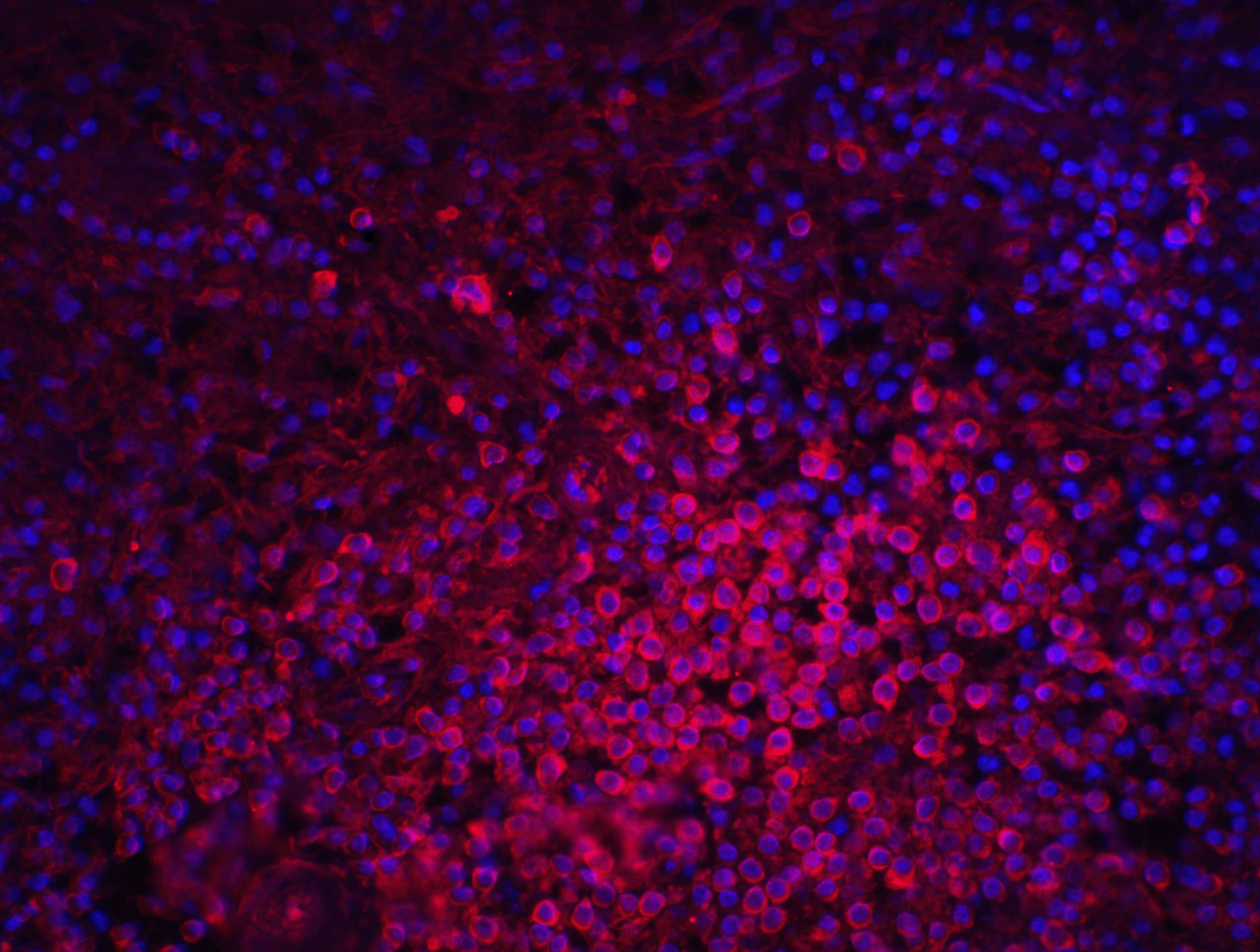 Immunocytochemistry/ Immunofluorescence: MD-2 Antibody - BSA Free [NBP1-77201] - Validation of MD-2 in Human Spleen Tissue.Immunofluorescent analysis of 4% paraformaldehyde-fixed human spleen tissue labeling MD-2 with  at 20 ug/mL, followed by goat anti-rabbit IgG secondary antibody at 1/500 dilution (red) and DAPI staining (blue).  