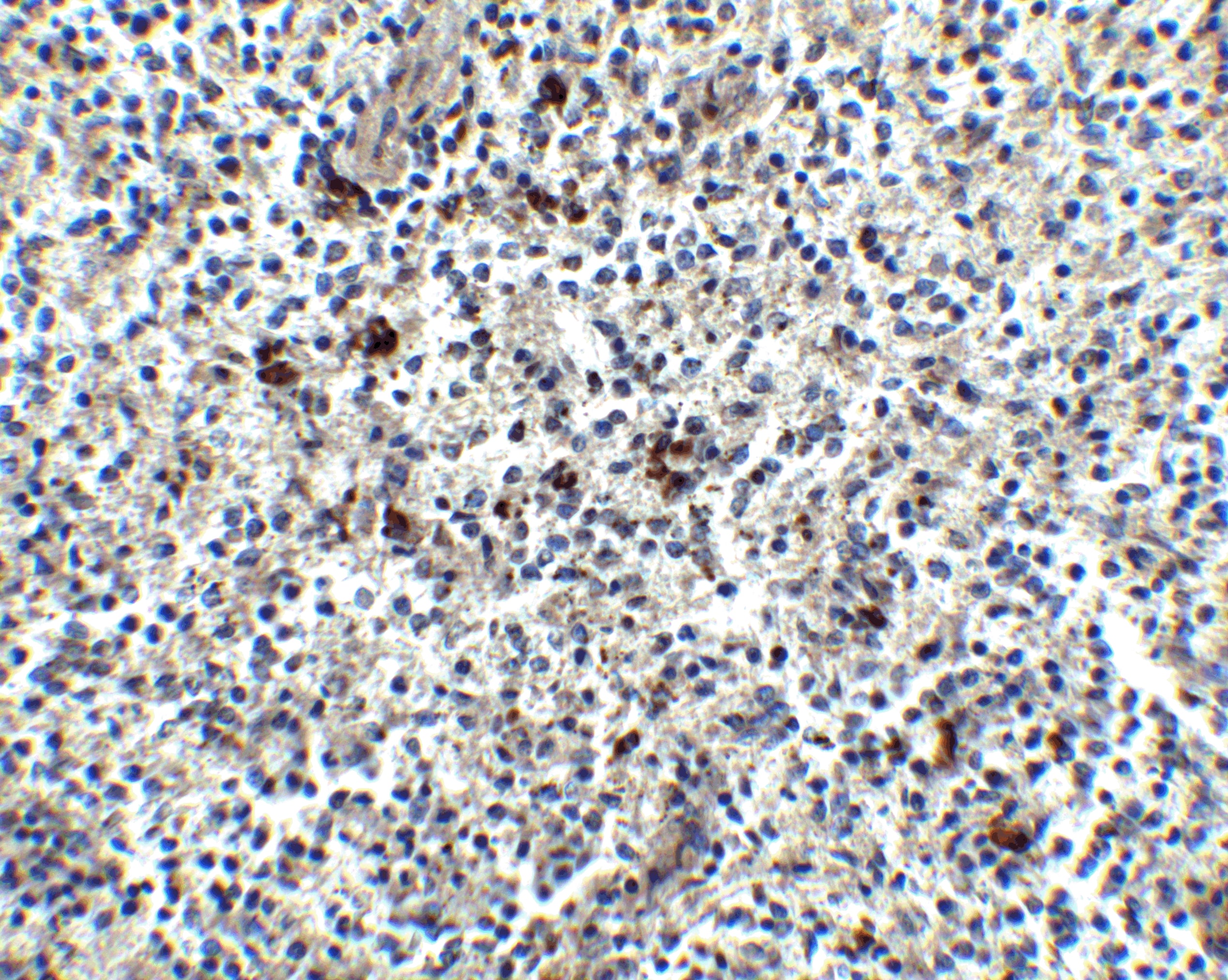 Immunohistochemistry: MD-2 Antibody - BSA Free [NBP1-77201] - Validation of MD-2 in Human Spleen Tissue.  Immunohistochemical analysis of paraffin-embedded human spleen tissue using anti-MD-2 antibody at 2.5 ug/ml. Tissue was fixed with formaldehyde and blocked with 10% serum for 1 h at RT; antigen retrieval was by heat mediation with a citrate buffer (pH6). Samples were incubated with primary antibody overnight at 4C. A goat anti-rabbit IgG H&L (HRP) at 1/250 was used as secondary. Counter stained with Hematoxylin.