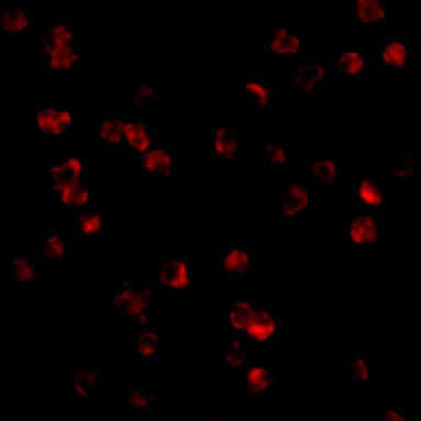 Immunocytochemistry/ Immunofluorescence: TLR8 Antibody - BSA Free [NBP1-77203] - Immunofluorescence of TLR8 in Daudi cells with TLR8 antibody at 10 u/mL.