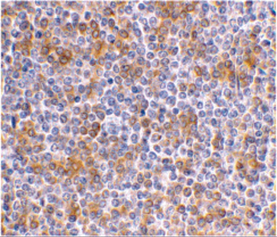 Immunohistochemistry: APOBEC3G Antibody - BSA Free [NBP1-77206] - Immunohistochemical staining of human spleen using APOBEC3G antibody at 1 ug/mL.