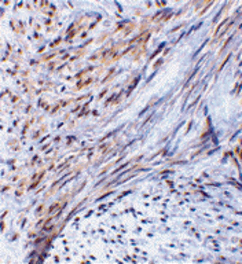 Immunohistochemistry: TRIM5 alpha Antibody - BSA Free [NBP1-77207] - Immunohistochemistry of TRIM5 alpha in human uterus tissue with TRIM5 alpha antibody at 2 ug/mL.