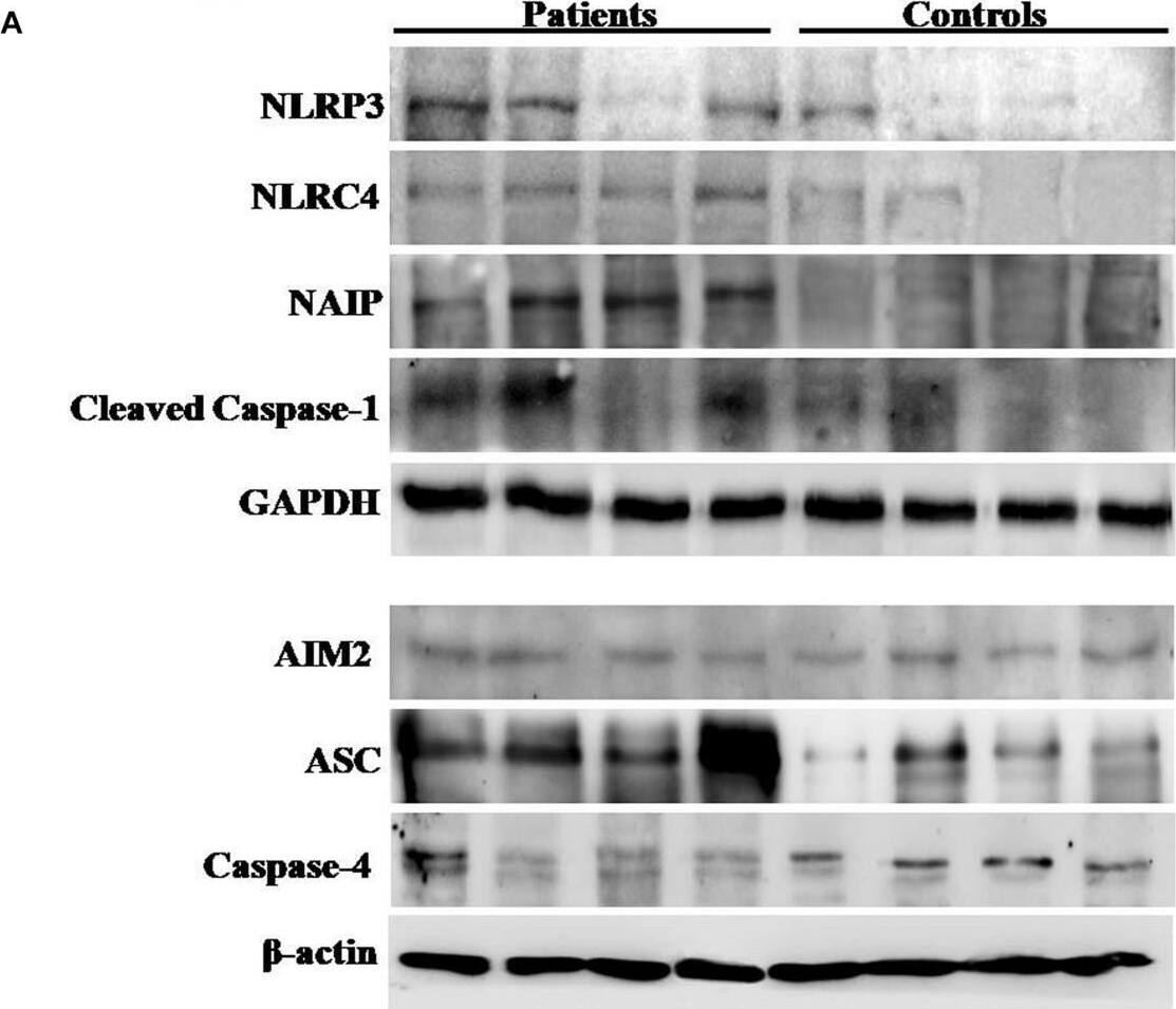 Western Blot Caspase-4 Antibody - BSA Free