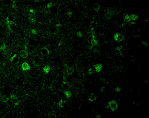 Immunocytochemistry/ Immunofluorescence: Rheb Antibody - BSA Free [NBP1-77214] - Immunofluorescence of Rheb in Mouse Brain cells with Rheb antibody at 20 u/mL.