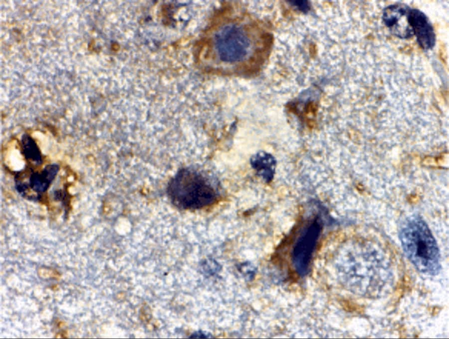 Immunohistochemistry: Rheb Antibody - BSA Free [NBP1-77214] - Immunohistochemistry of Rheb in mouse brain tissue with Rheb antibody at 2 ug/mL.