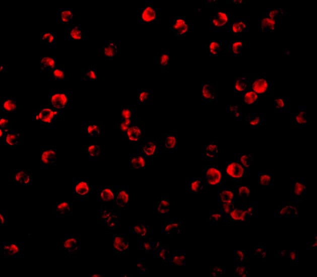 Immunocytochemistry/ Immunofluorescence: IRS1 Antibody - BSA Free [NBP1-77216] - Immunofluorescence of IRS1 in P815 cells with IRS1 antibody at 2 ug/mL.