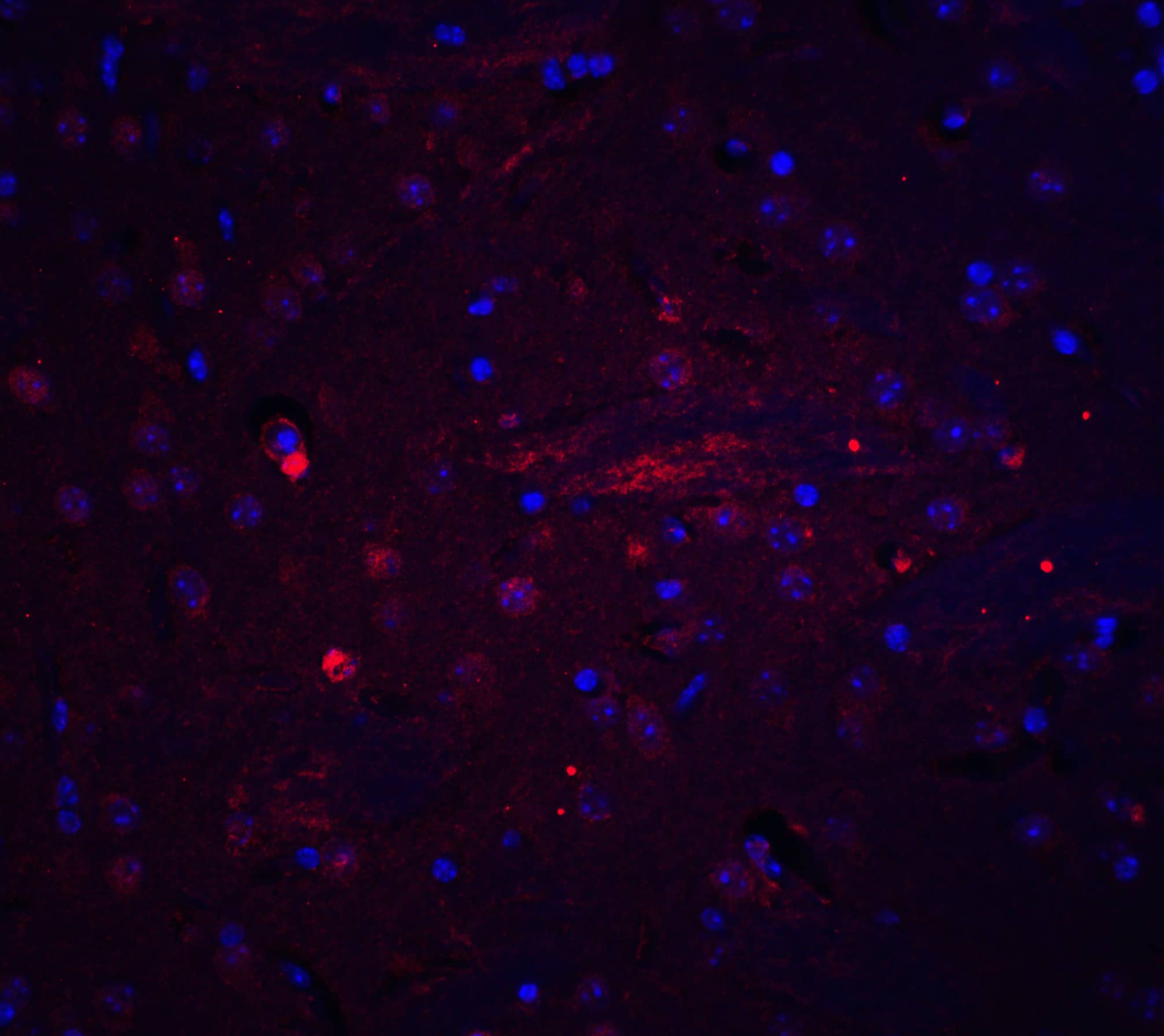 Immunocytochemistry/ Immunofluorescence: Adiponectin/Acrp30 Antibody - BSA Free [NBP1-77217] - Immunofluorescence of Adiponectin/Acrp30 in mouse brain tissue with Adiponectin/Acrp30 antibody at 20 ug/mL.Red: Adiponectin/Acrp30 Antibody   Blue: DAPI staining