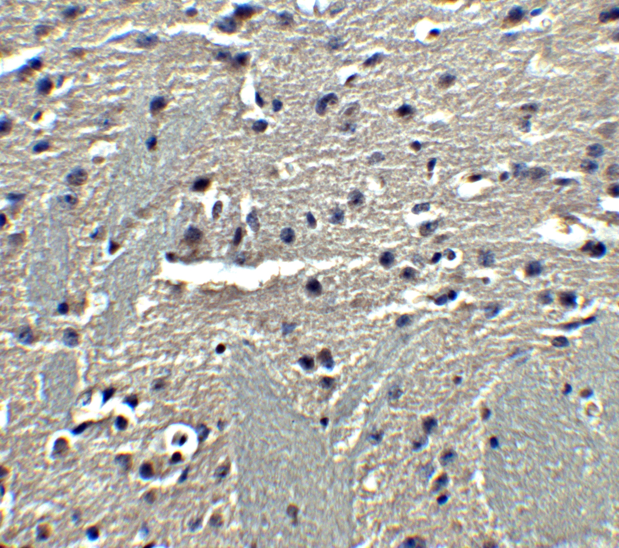 Immunohistochemistry: Adiponectin/Acrp30 Antibody - BSA Free [NBP1-77217] - Immunohistochemistry of Adiponectin in mouse brain tissue with Adiponectin antibody at 5 u/ml.