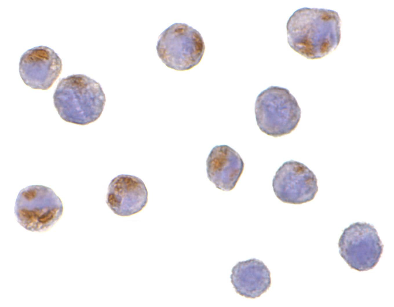 Immunocytochemistry/ Immunofluorescence: CTRP6 Antibody - BSA Free [NBP1-77218] - Immunocytochemistry of CTRP6 in HeLa cells with CTRP6 antibody at 10 u/mL.