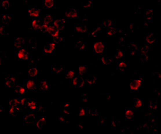 Immunocytochemistry/ Immunofluorescence: IRAK4 Antibody - BSA Free [NBP1-77231] - Validation of IRAK4 in K562 Cells. Immunofluorescent analysis of 4% paraformaldehyde-fixed K562 Cells labeling IRAK4 with  at 10 ug/mL, followed by goat anti-rabbit IgG secondary antibody at 1/500 dilution (red).  