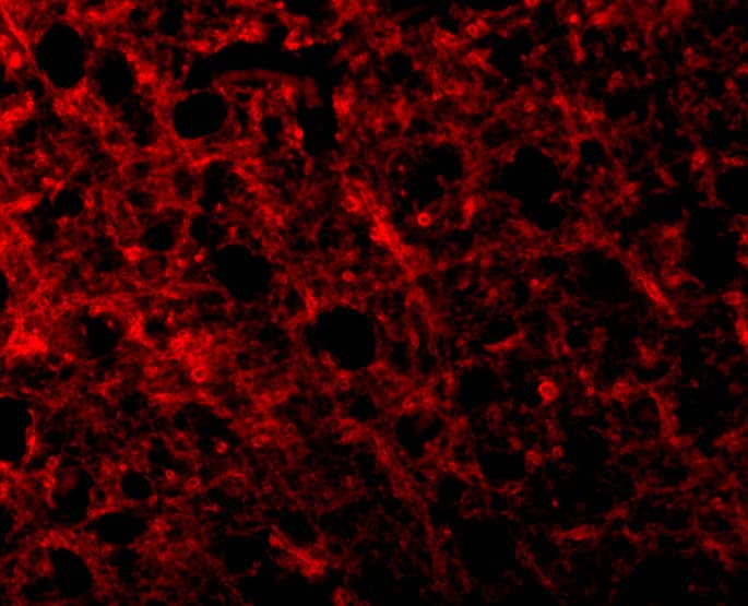 Immunocytochemistry/ Immunofluorescence: TEM8/ANTXR1 Antibody - BSA Free [NBP1-77233] - Immunofluorescence of TEM8/ANTXR1 in Human Brain tissue with TEM8/ANTXR1 antibody at 10 ug/mL.