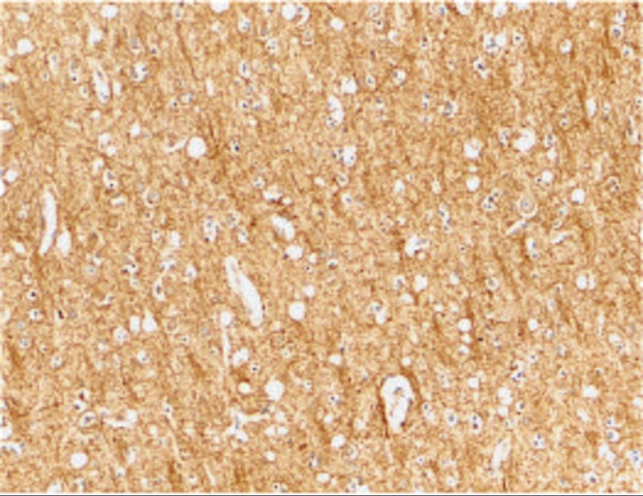 Immunohistochemistry: TEM8/ANTXR1 Antibody - BSA Free [NBP1-77233] - Immunohistochemical staining of human brain tissue using TEM8/ANTXR1 antibody at 2 u/mL. 