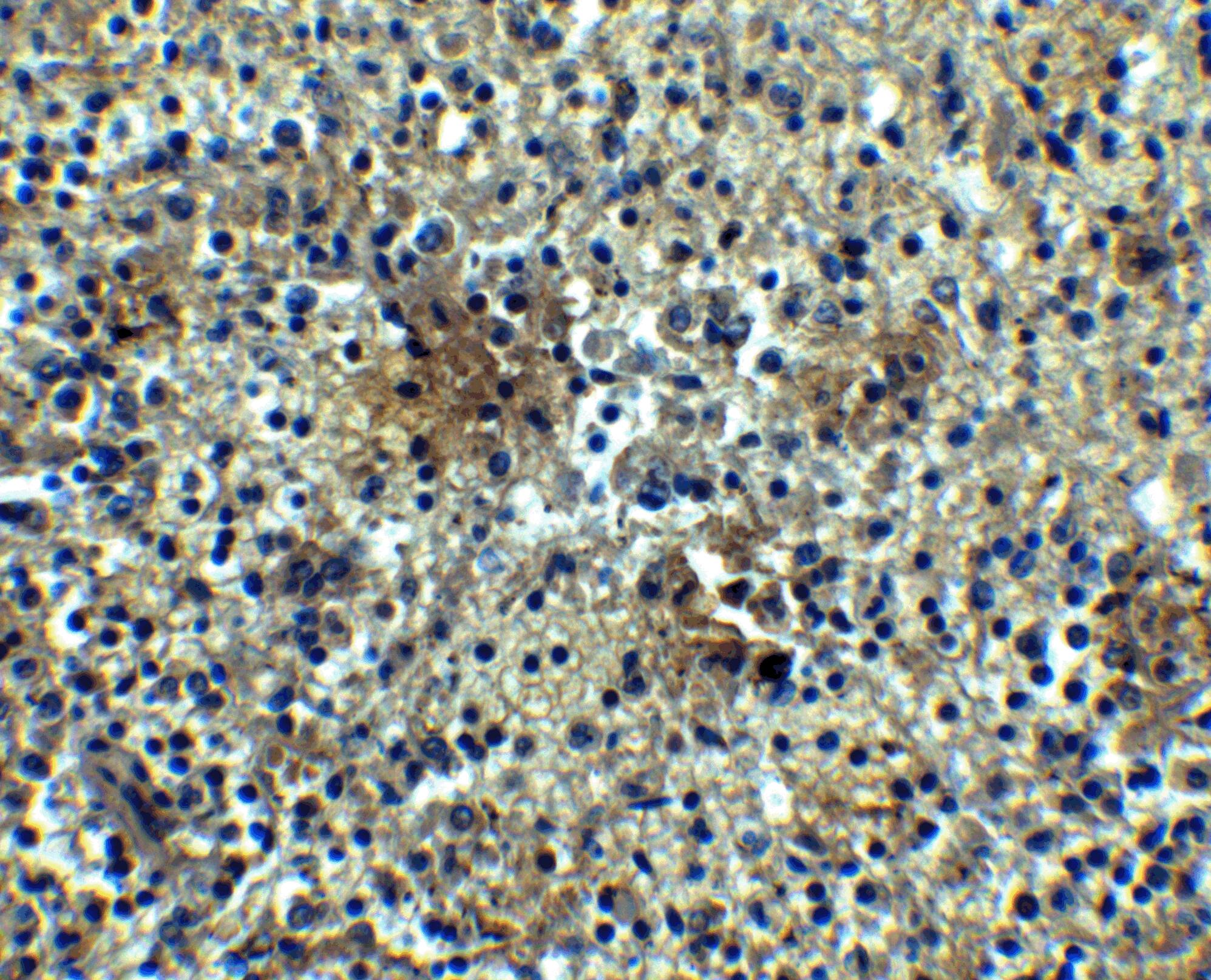 Immunohistochemistry: BAFFR/TNFRSF13C Antibody - BSA Free [NBP1-77234] - Immunohistochemistry of BAFFR/TNFRSF13C in human spleen tissue with BAFFR/TNFRSF13C antibody at 5 u/mL.