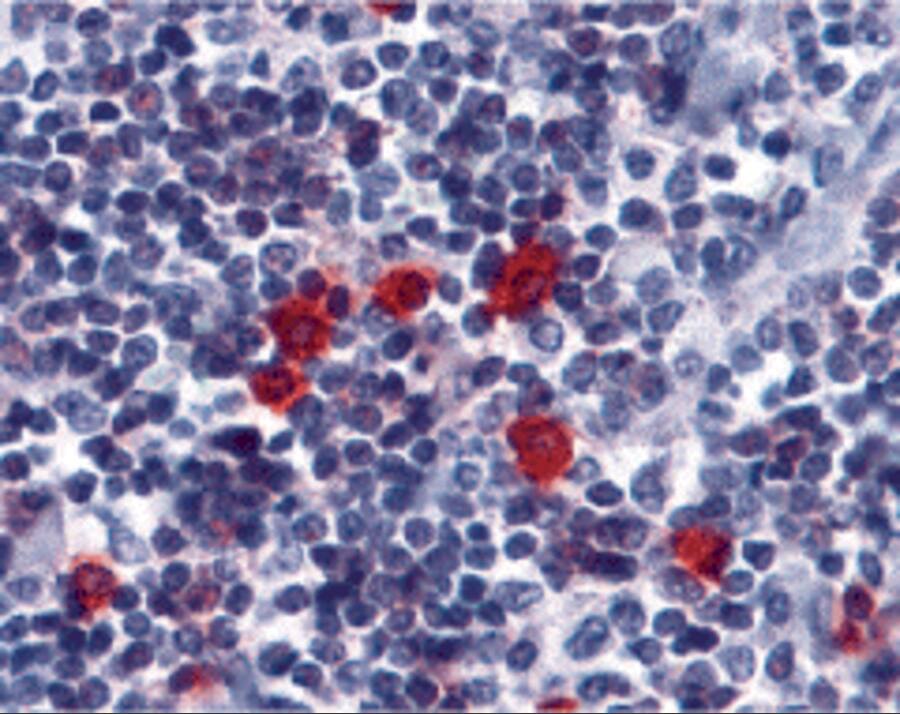 Immunohistochemistry: BAFFR/TNFRSF13C Antibody - BSA Free [NBP1-77234] - Immunohistochemistry of BAFF Receptor in human tonsil tissue with BAFF Receptor antibody at 5 u/mL.