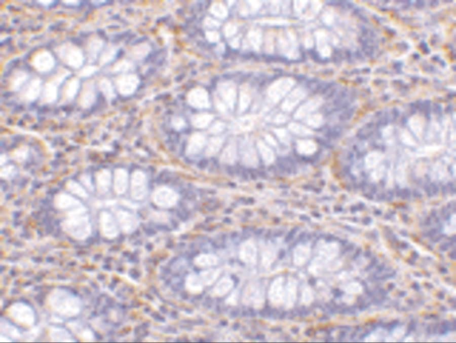 Immunohistochemistry: PAK4 Antibody - BSA Free [NBP1-77236] - Immunohistochemistry of PAK4 in human colon tissue with PAK4 antibody at 10 u/mL.