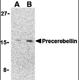 Western Blot Cerebellin-1/Precerebellin Antibody - BSA Free