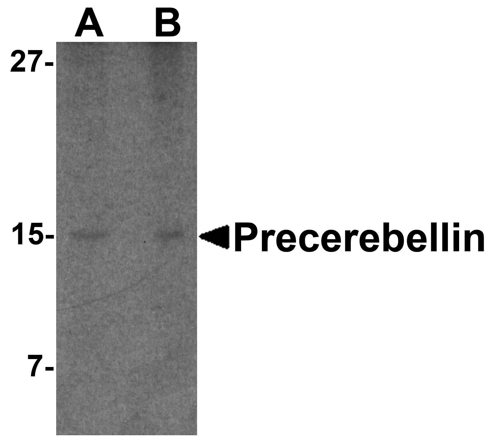 Western Blot: Cerebellin-1/Precerebellin Antibody - BSA Free [NBP1-77239] - Western blot analysis of Cerebellin-1/Precerebellin in mouse cerebellum lysate with Cerebellin-1/Precerebellin antibody at (A) 2 and (B) 4 ug/mL.