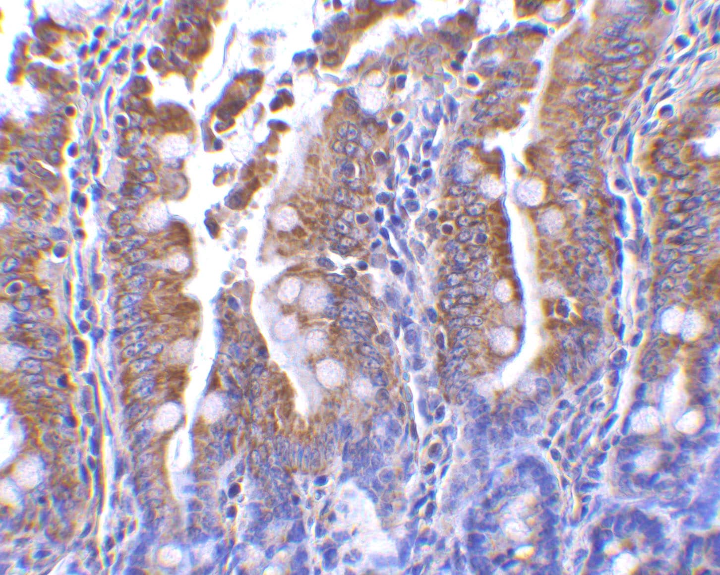 Immunohistochemistry PIST Antibody - BSA Free