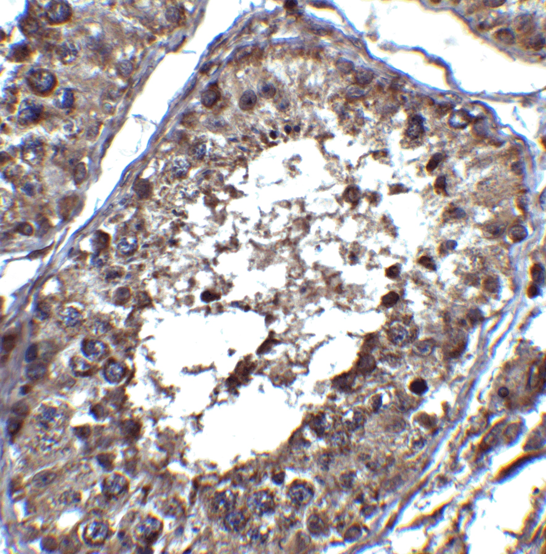 Immunohistochemistry PIST Antibody - BSA Free