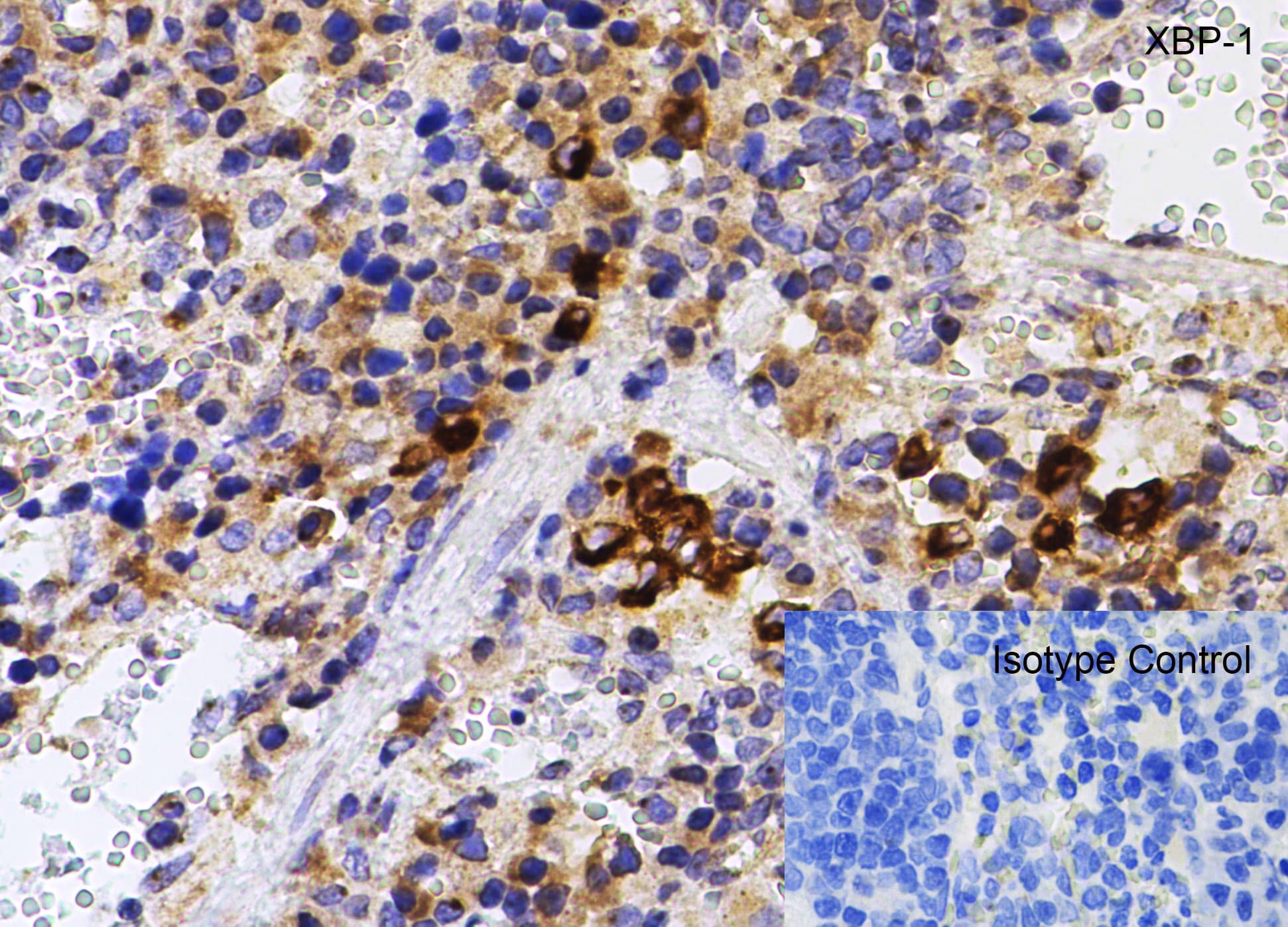 Immunohistochemistry: XBP1 Antibody - BSA Free [NBP1-77253] - Validation of XBP1 in Rat Spleen Tissue.Immunohistochemical analysis of paraffin-embedded rat spleen tissue using anti-XBP1 antibody at 1 u /ml. Tissue was fixed with formaldehyde and blocked with 10% serum for 1 h at RT; antigen retrieval was by heat mediation with a citrate buffer (pH6). Samples were incubated with primary antibody overnight at 4 C. A goat anti-rabbit IgG H&L (HRP) at 1/250 was used as secondary. Counter stained with Hematoxylin.