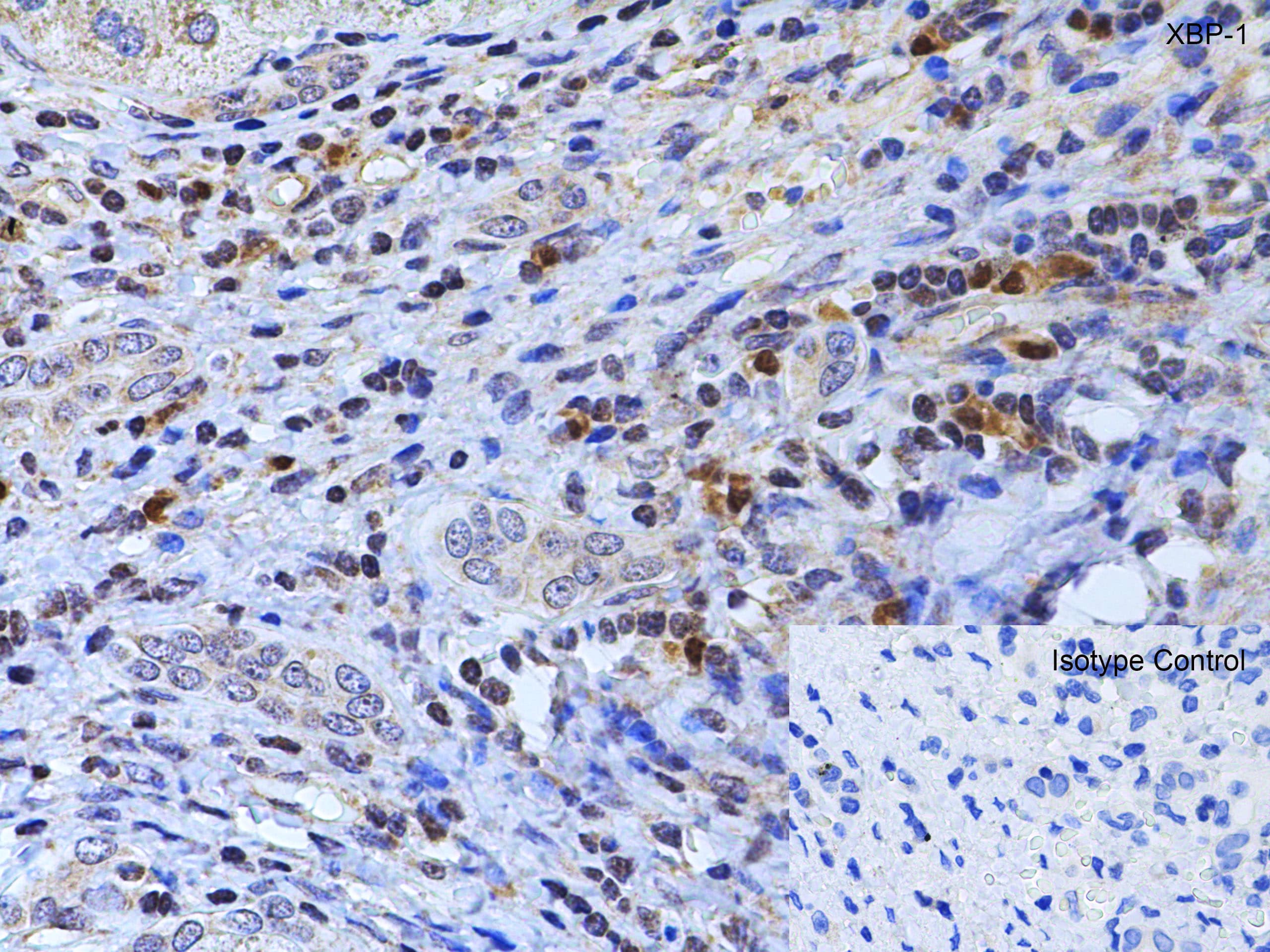 Immunohistochemistry: XBP1 Antibody - BSA Free [NBP1-77253] - Validation of XBP1 in Human Liver Tissue.Immunohistochemical analysis of paraffin-embedded human liver tissue using anti-XBP1 antibody  at 1 u /ml. Tissue was fixed with formaldehyde and blocked with 10% serum for 1 h at RT; antigen retrieval was by heat mediation with a citrate buffer (pH6). Samples were incubated with primary antibody overnight at 4C. A goat anti-rabbit IgG H&L (HRP) at 1/250 was used as secondary. Counter stained with Hematoxylin.