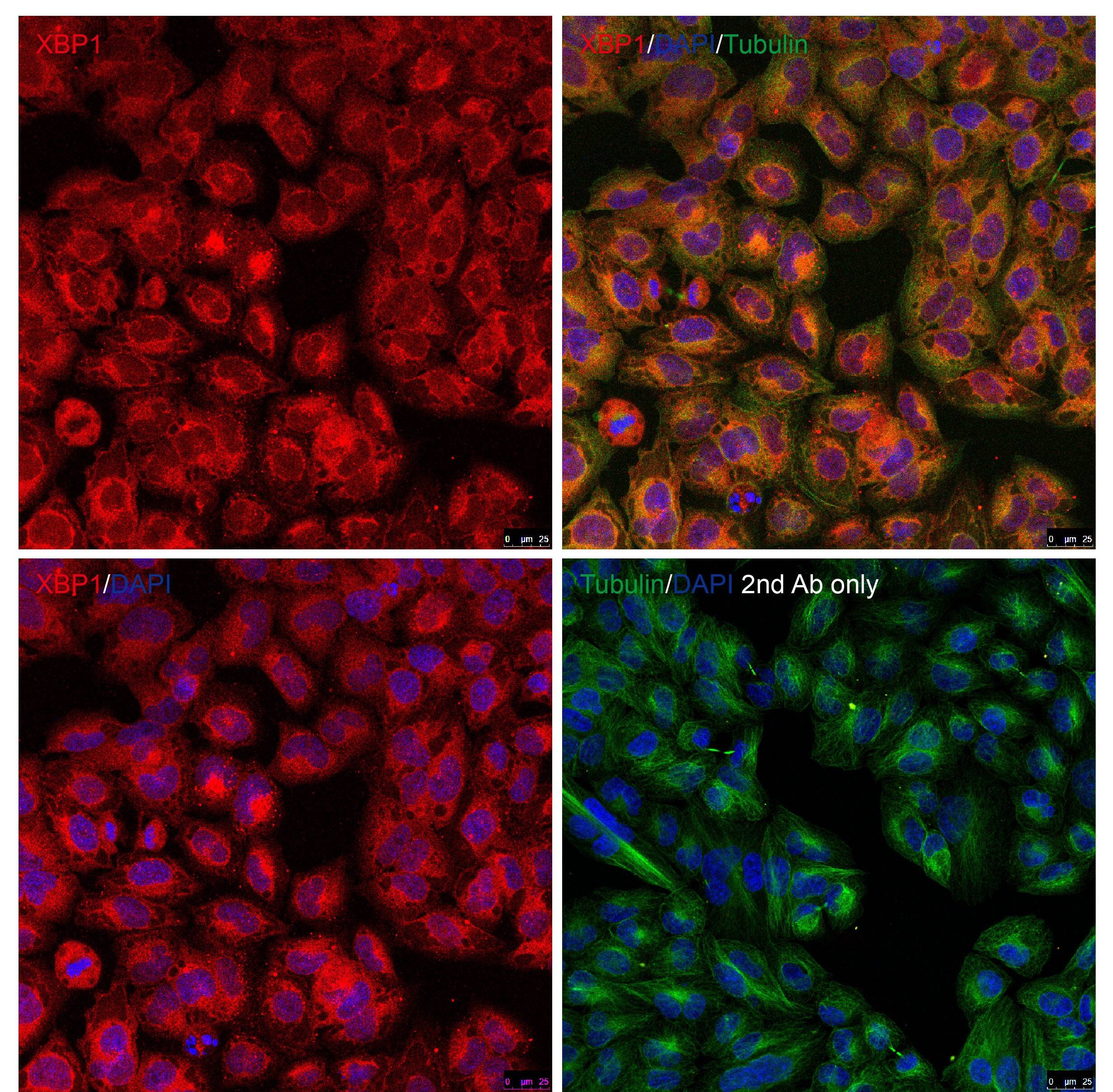 Immunocytochemistry/ Immunofluorescence: XBP1 Antibody - BSA Free [NBP1-77253] - Validation of XBP-1 in HeLa CellsImmunofluorescent analysis of methanol-fixed HeLa cells labeling XBP-1 with  at 10 u/mL, followed by goat anti-rabbit IgG secondary antibody at 1/1000 dilution (red) and DAPI staining (blue). Alpha tubulin was stained with anti-alpha tubulin antibody following by goat anti-mouse IgG secondary antibody (green). Images were captured with confocal microscopy. 