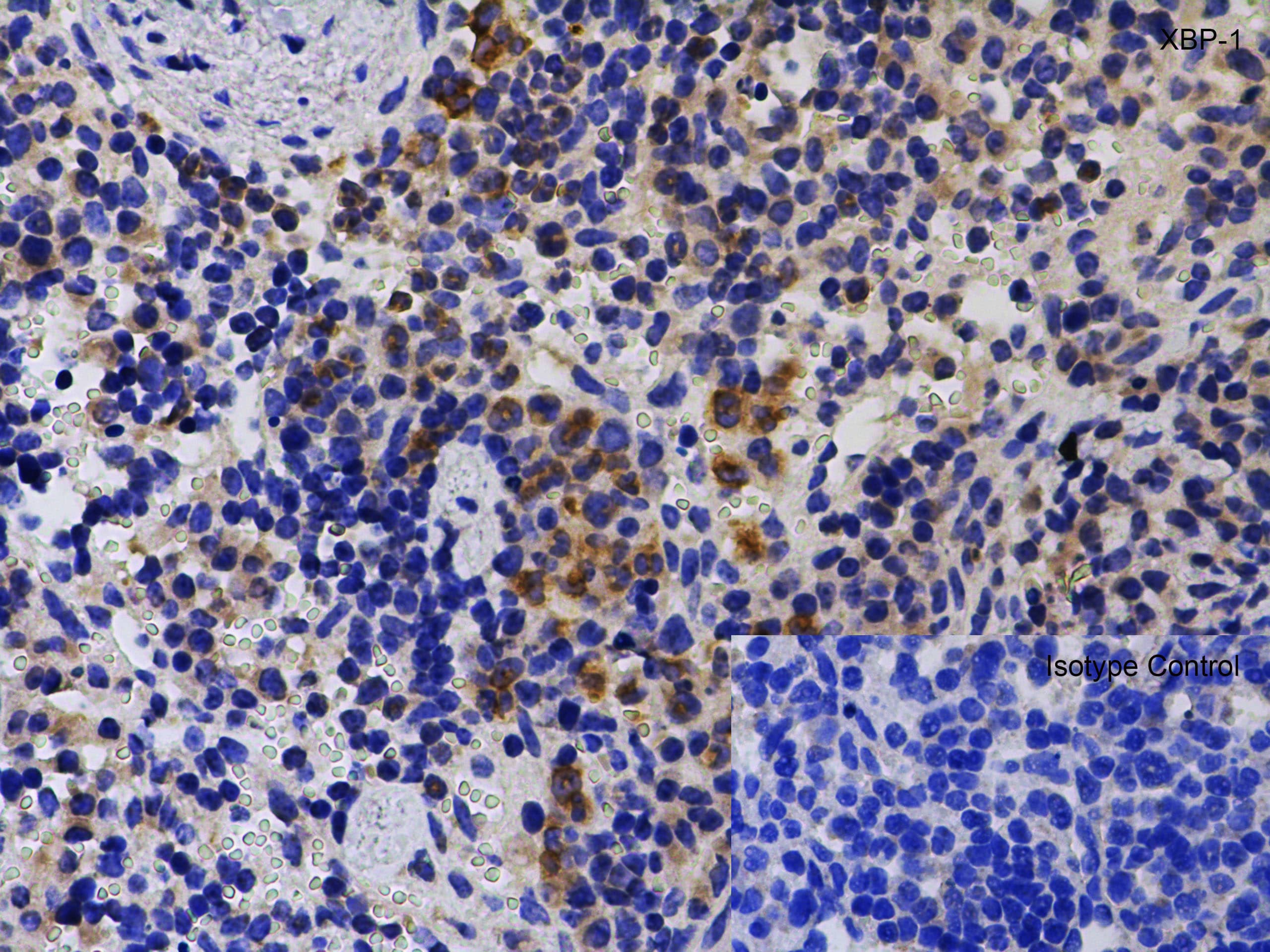 Immunohistochemistry: XBP1 Antibody - BSA Free [NBP1-77253] - Validation of XBP1 in Mouse Spleen Tissue.Immunohistochemical analysis of paraffin-embedded mouse spleen tissue using anti-XBP1 antibody  at 1 u /ml. Tissue was fixed with formaldehyde and blocked with 10% serum for 1 h at RT; antigen retrieval was by heat mediation with a citrate buffer (pH6). Samples were incubated with primary antibody overnight at 4 C. A goat anti-rabbit IgG H&L (HRP) at 1/250 was used as secondary. Counter stained with Hematoxylin.