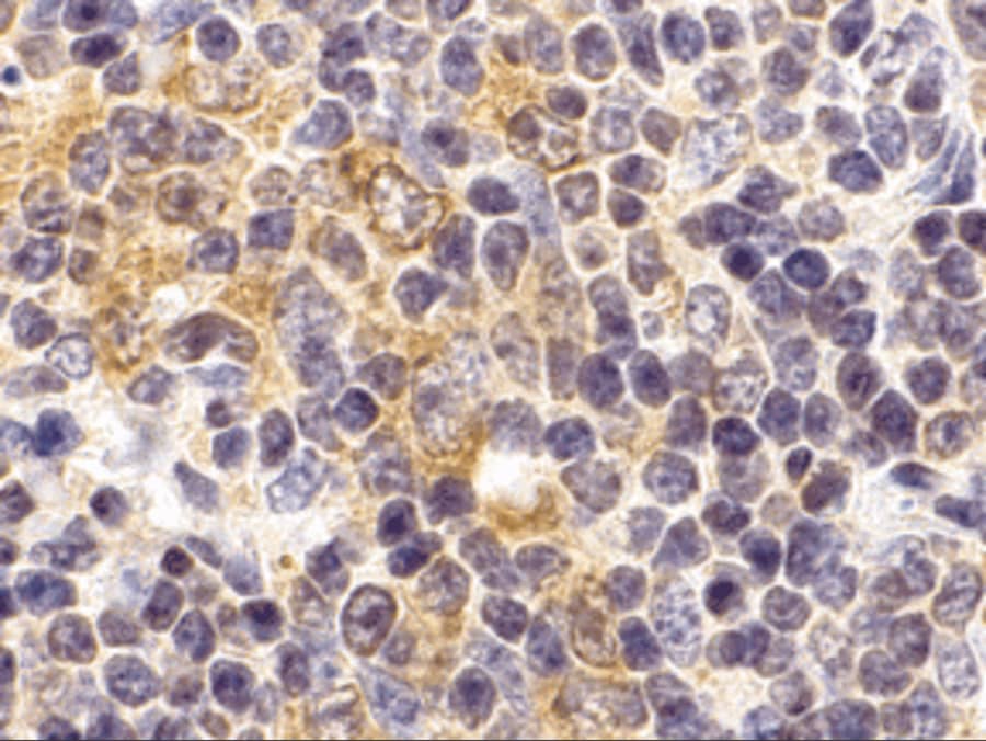 Immunohistochemistry: TLR9 Antibody - BSA Free [NBP1-77254] - Immunohistochemistry of TLR9 in mouse spleen cells with TLR9 antibody at 2 u/mL.