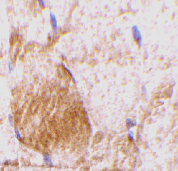 Immunohistochemistry: IL-31 Antibody - BSA Free [NBP1-77256] - Immunohistochemistry of IL-31 in rat skeletal muscle tissue with IL-31 antibody at 10 ug/mL.