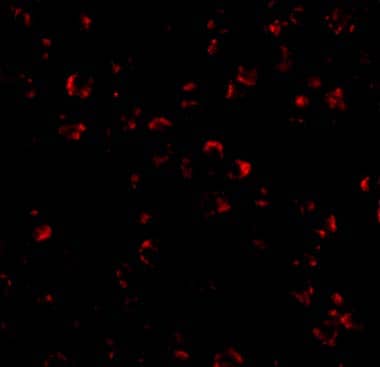 Immunocytochemistry/ Immunofluorescence: IL-23A/IL-23 P19 Antibody - BSA Free [NBP1-77257] - Validation of IL-23A/IL-23 P19 in Raji Cells. Immunofluorescent analysis of 4% paraformaldehyde-fixed Raji Cells labeling IL-23A/IL-23 P19 with  at 20 ug/mL, followed by goat anti-rabbit IgG secondary antibody at 1/500 dilution (red).  