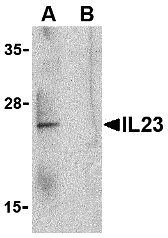 Western Blot: IL-23A/IL-23 P19 Antibody - BSA Free [NBP1-77257] - Validation in Human Raji Cells. Loading: 15 ug of lysates per lane.Antibodies: IL-23A/IL-23 P19  (1 u/mL), 1h incubation at RT in 5% NFDM/TBST.Secondary: Goat anti-rabbit IgG HRP conjugate at 1:10000 dilution.Lane A: Absence of blocking peptideLane B: Presence of blocking peptide.