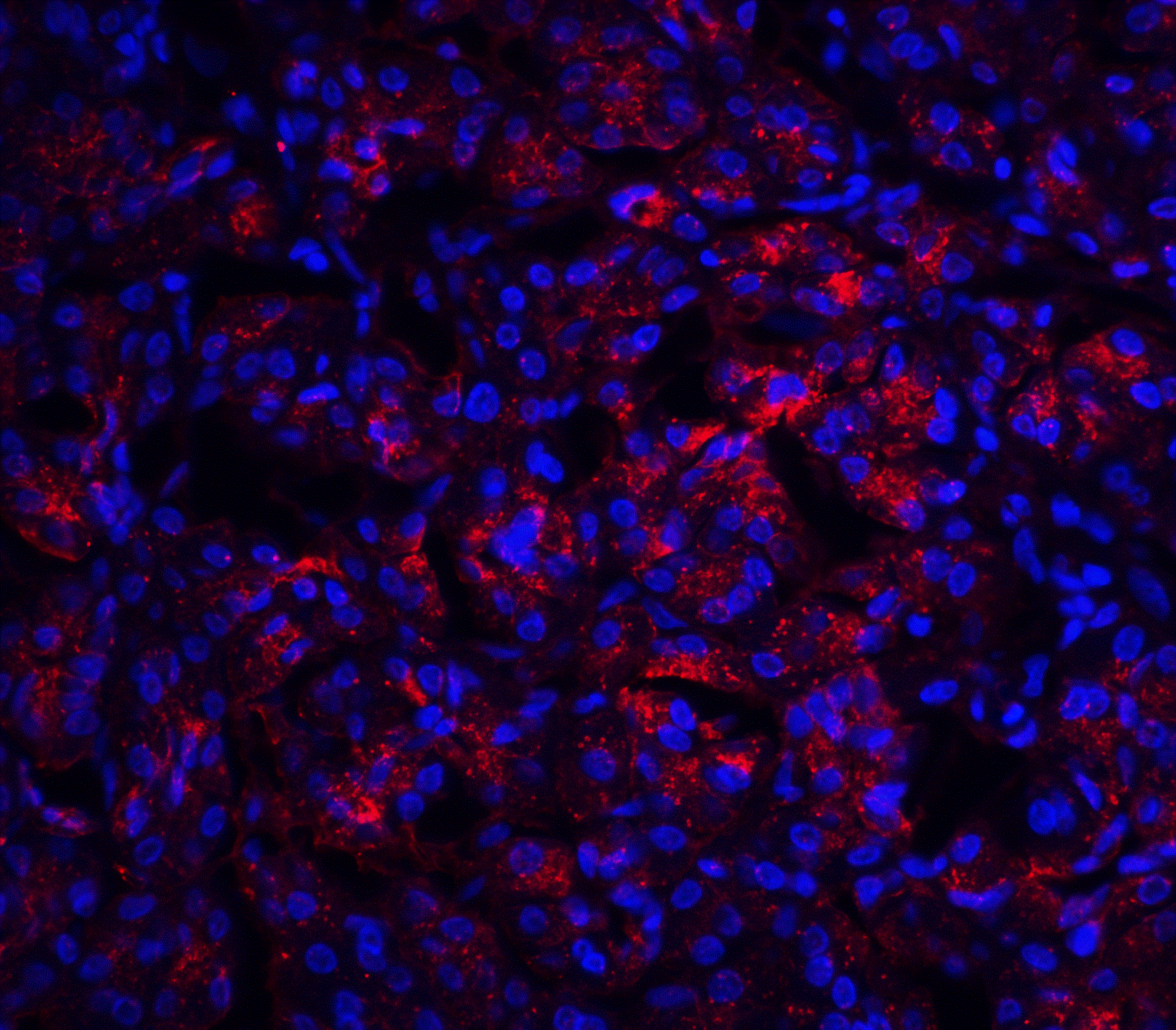 Immunocytochemistry/ Immunofluorescence: IL-23A/IL-23 P19 Antibody - BSA Free [NBP1-77257] - Validation of IL-23A/IL-23 P19 in Human Pancreas Tissue. Immunofluorescent analysis of 4% paraformaldehyde-fixed human pancreas tissue labeling IL-23A/IL-23 P19 with  at 20 ug/mL, followed by goat anti-rabbit IgG secondary antibody at 1/500 dilution (red) and DAPI staining (blue).