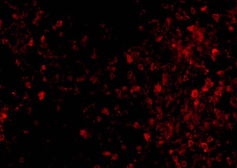 Immunocytochemistry/ Immunofluorescence TRPC6 Antibody - BSA Free