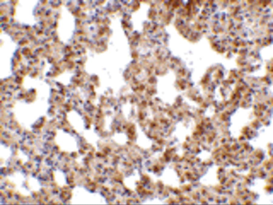 Immunohistochemistry TRPC6 Antibody - BSA Free