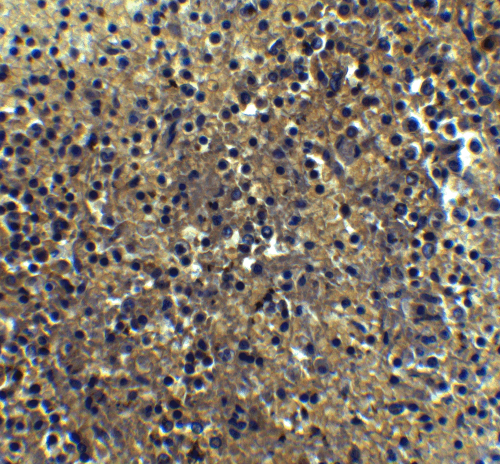 Immunohistochemistry: IRF7 Antibody - BSA Free [NBP1-77263] - Immunohistochemistry of IRF7 in human spleen tissue with IRF7 Antibody at 5 u/mL.