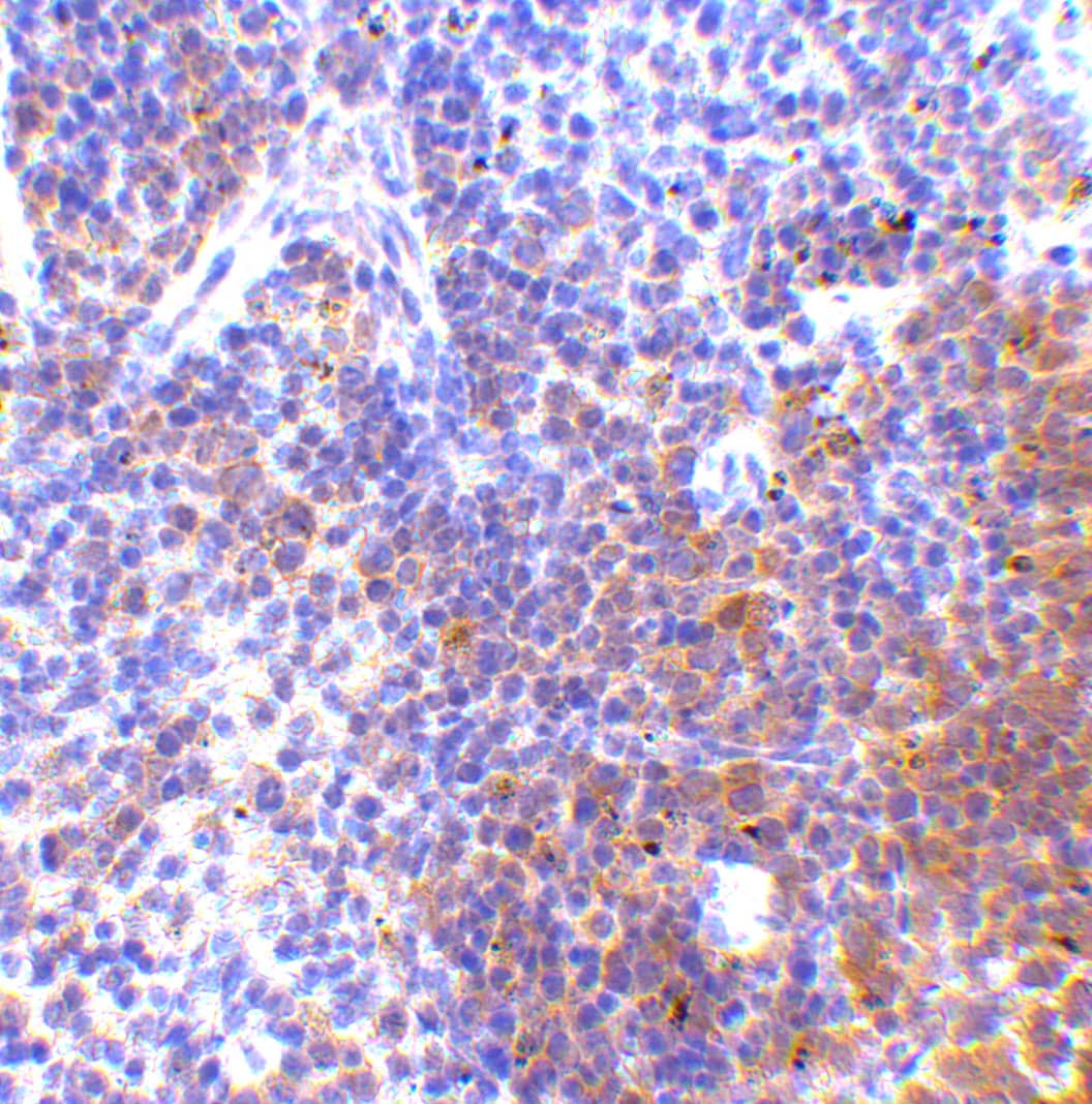 Immunohistochemistry: IRF7 Antibody - BSA Free [NBP1-77263] - Immunohistochemistry of IRF7 in mouse spleen tissue with IRF7 antibody at 5 u/mL.