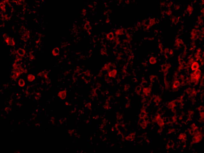 Immunocytochemistry/ Immunofluorescence: PKR Antibody - BSA Free [NBP1-77266] - Validation of PKR in Mouse LungImmunofluorescent analysis of 4% paraformaldehyde-fixed mouse lung tissue labeling PKR with  at 20 ug/mL, followed by goat anti-rabbit IgG secondary antibody at 1/500 dilution (red). 