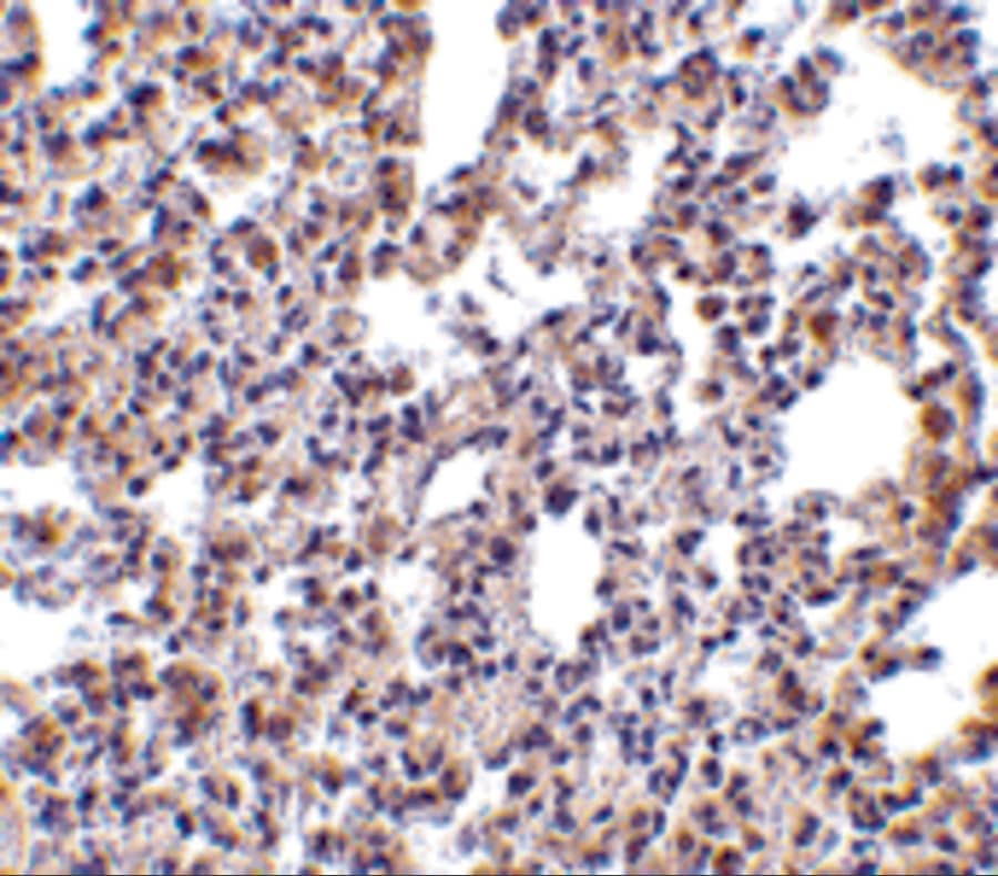 Immunohistochemistry: PKR Antibody - BSA Free [NBP1-77266] - Validation of PKR in Rat Lung.  Immunohistochemical analysis of paraffin-embedded rat lung tissue using anti-PKR antibody  at 2.5 ug/ml. Tissue was fixed with formaldehyde and blocked with 10% serum for 1 h at RT; antigen retrieval was by heat mediation with a citrate buffer (pH6). Samples were incubated with primary antibody overnight at 4C. A goat anti-rabbit IgG H&L (HRP) at 1/250 was used as secondary. Counter stained with Hematoxylin.