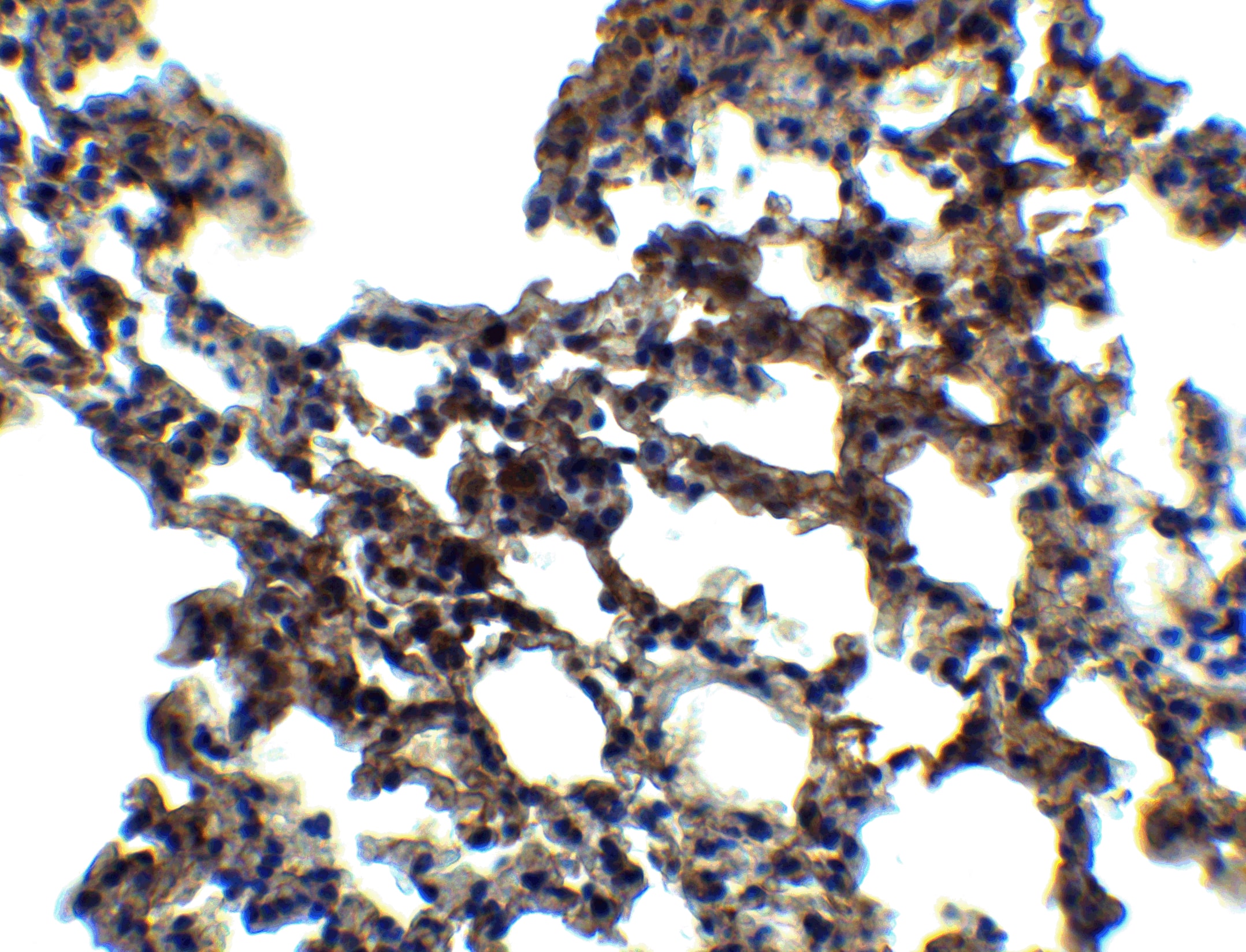 Immunohistochemistry PKR Antibody - BSA Free