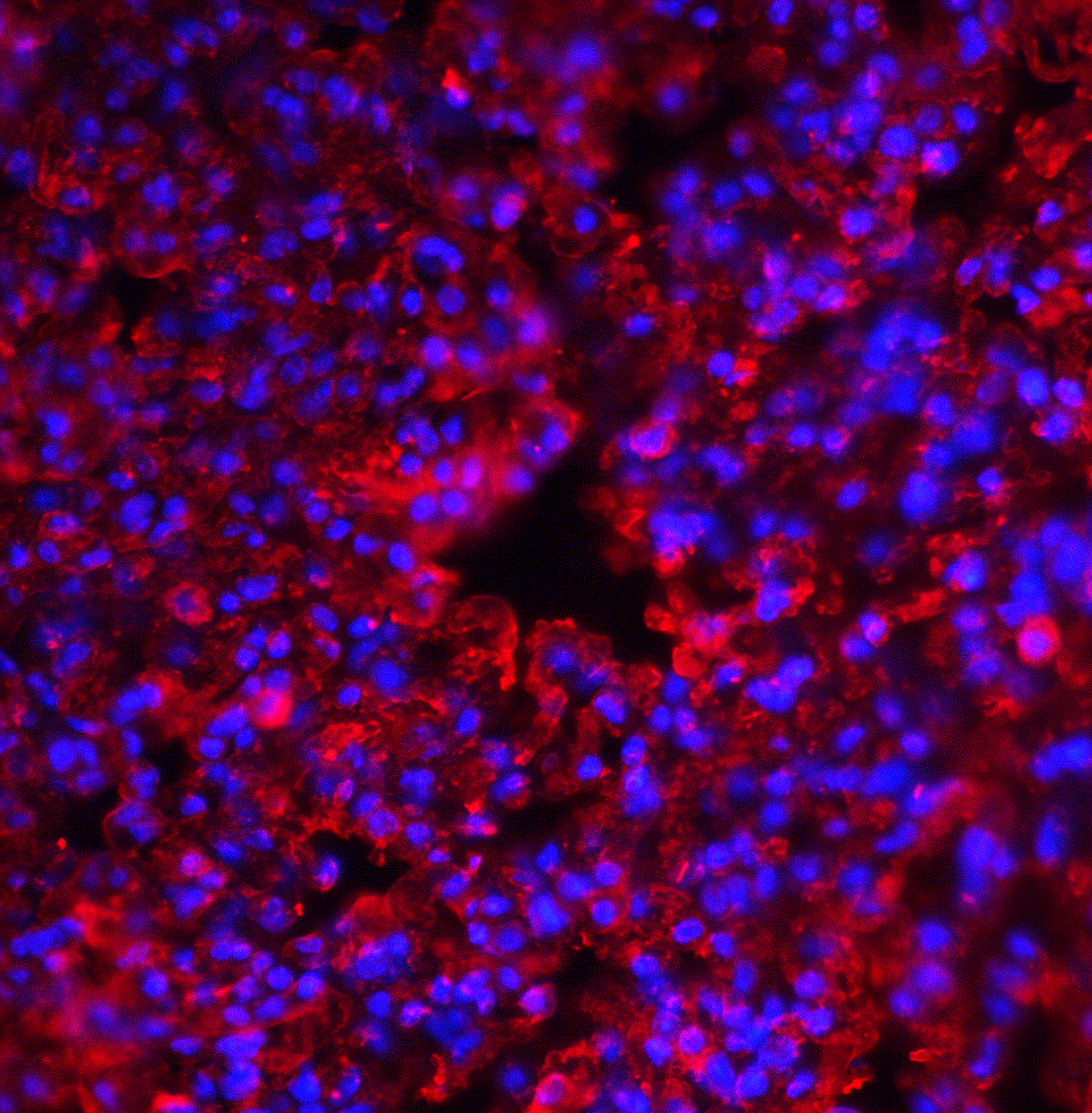 Immunocytochemistry/ Immunofluorescence: PKR Antibody - BSA Free [NBP1-77266] - Validation of PKR in Mouse Lung. Immunofluorescent analysis of 4% paraformaldehyde-fixed mouse lung tissue labeling PKR with  at 20 ug/mL, followed by goat anti-rabbit IgG secondary antibody at 1/500 dilution (red) and DAPI staining (blue). 