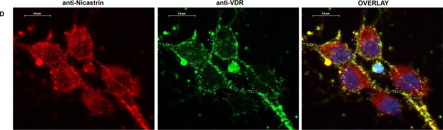 Cell surface staining of VDR (green) on live neurons followed by fixation and immunofluorescence labeling of target proteins (100x): A) ADAM10; B) APP; C) BACE1; D) Nicastrin; E) Presenilin 1; F) Presenilin 2. Overlay images indicate the possible co-localization of VDR/ADAM10 (A) or VDR/APP (B) or VDR/Nicastrin (D) or limited co-localization of VDR/ Presenilin 1 (E) on the neuronal plasma membrane. Overlay images do not indicate co-localization for VDR/BACE1 (C) or VDR/Presenilin 2 (F) on the neuronal plasma membrane. Image collected and cropped by CiteAb from the following open publication (//pubmed.ncbi.nlm.nih.gov/29176823), licensed under a CC-BY license. Not internally tested by Novus Biologicals.