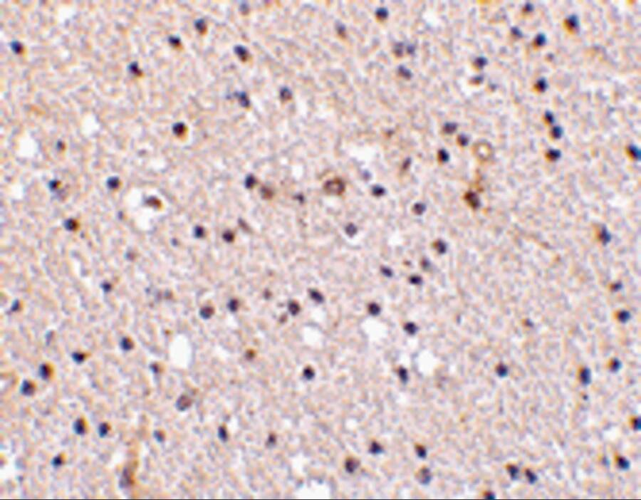 Immunohistochemistry: Nicastrin Antibody - BSA Free [NBP1-77270] - Immunohistochemistry of Nicastrin in human brain tissue with Nicastrin antibody at 2.5 ug/mL.