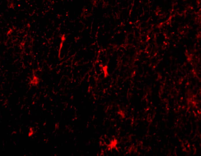 Immunocytochemistry/ Immunofluorescence: Nicastrin Antibody - BSA Free [NBP1-77270] - Immunofluorescence of Nicastrin in Human Brain cells with Nicastrin antibody at 20 ug/mL.