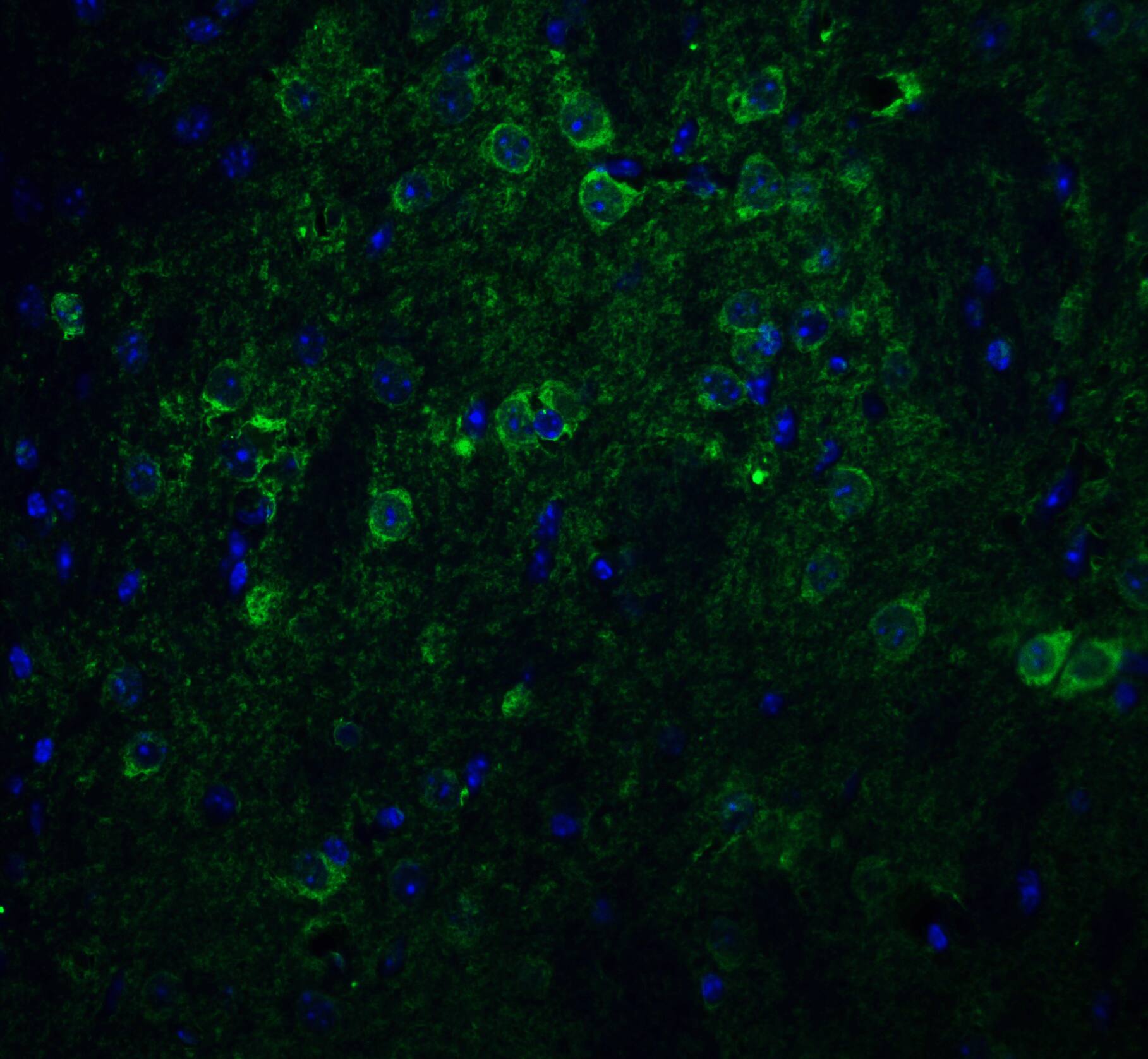 Immunocytochemistry/ Immunofluorescence: Nicastrin Antibody - BSA Free [NBP1-77270] - Immunofluorescence of Nicastrin in mouse brain tissue with Nicastrin antibody at 20 ug/ml.Green: Nicastrin Antibody   Blue: DAPI staining