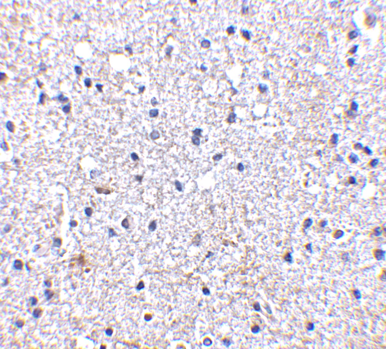 Immunohistochemistry SCO1 Antibody - BSA Free