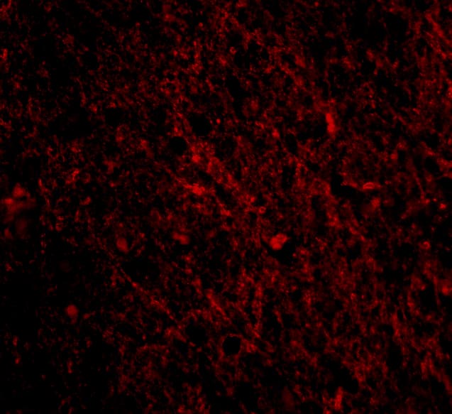 Immunocytochemistry/ Immunofluorescence: SCO1 Antibody - BSA Free [NBP1-77273] - Immunofluorescence of SCO1 in Human Brain cells with SCO1 antibody at 20 ug/mL.