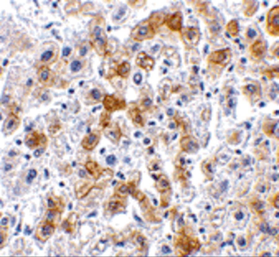 Immunohistochemistry SCO2 Antibody - BSA Free