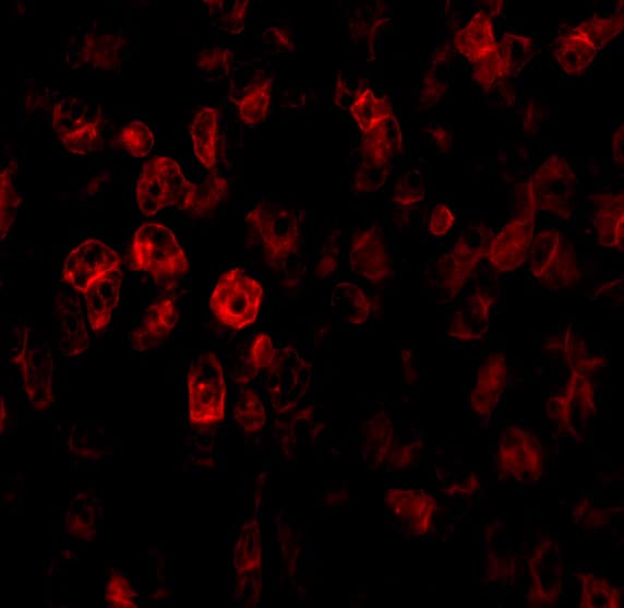 Immunocytochemistry/ Immunofluorescence SCO2 Antibody - BSA Free